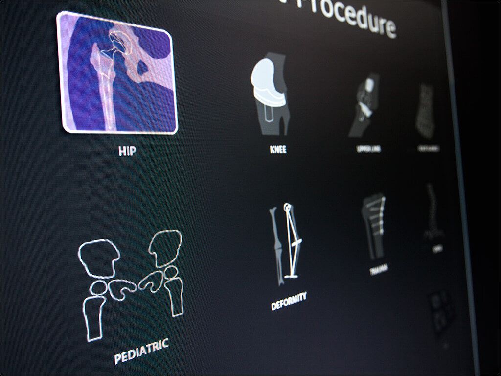 traumacad orthopedic digital templating