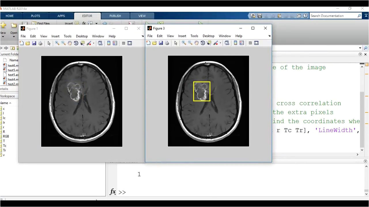 Template Matching In Image Processing Template Matching Image Processing and Computer Vision
